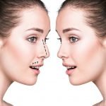 عمليات تجميل الانف