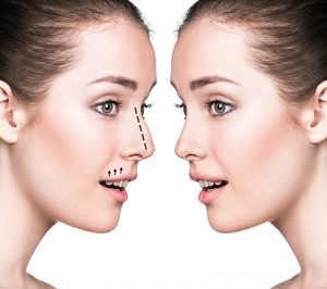 عمليات تجميل الانف
