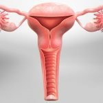 استئصال الرحم