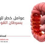 colon cancer