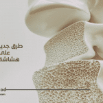 طرق جديدة للتغلب على آلام هشاشة العظام