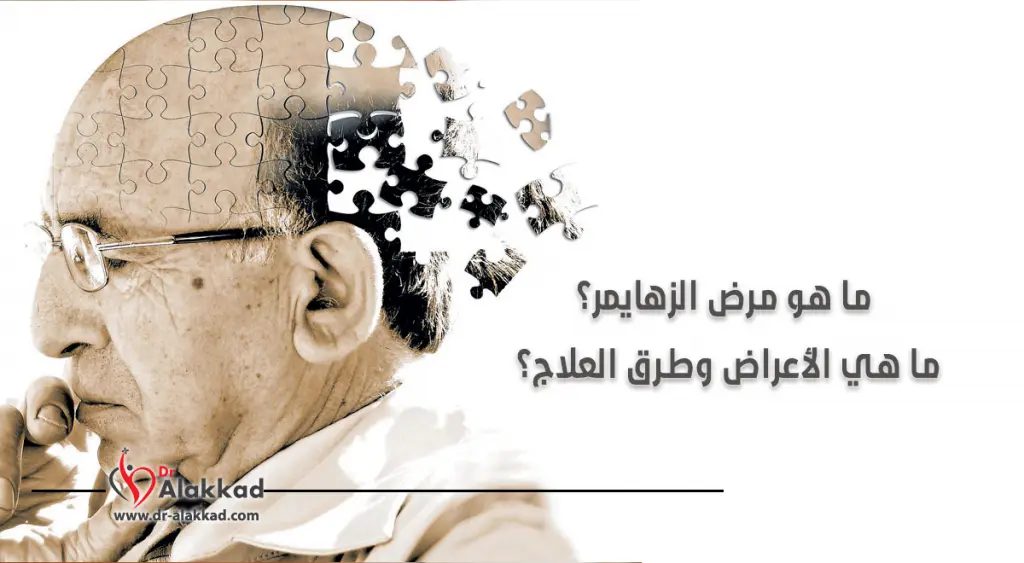 ما هو مرض الزهايمر؟ ما هي الأعراض وطرق العلاج؟
