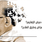 الزهايمر