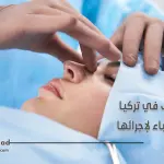 تجميل الانف في تركيا وافضل الأطباء لاجرائها