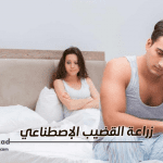 زراعة القضيب الاصطناعي في تركيا