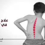 علاج الجنف في تركيا