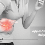 علاج حصوات المرارة بدون جراحة