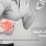 علاج حصوات المرارة بدون جراحة