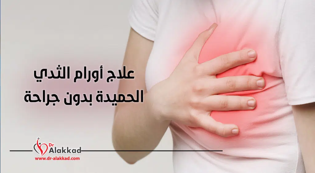 علاج أورام الثدي الحميدة بدون جراحة!