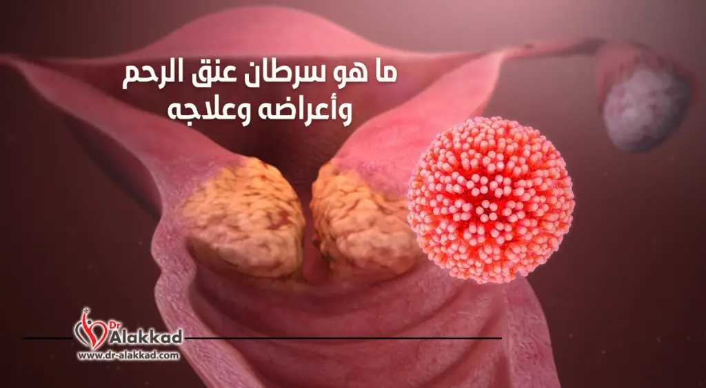 ما هو سرطان عنق الرحم وأعراضه وعلاجه