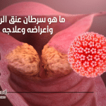 سرطان عنق الرحم