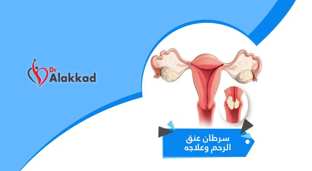 سرطان عنق الرحم وعلاجه