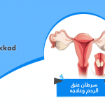 سرطان عنق الرحم وعلاجه