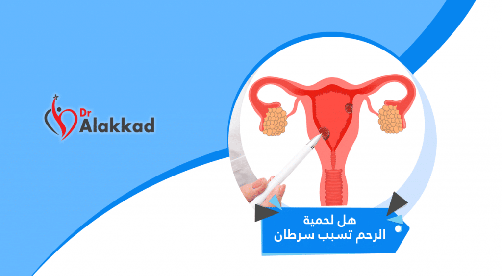 هل لحمية الرحم تسبب سرطان ومتى تكون خطيرة؟ واعراض سرطان الرحم المبكرة
