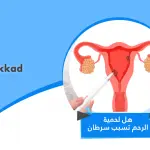 هل لحمية الرحم تسبب سرطان
