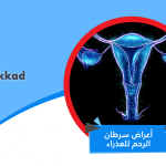 اعراض سرطان الرحم للعذراء والتشخيص والعلاج