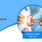 تكلفة زراعة الكلى في تركيا