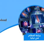 جراحة العظام في تركيا