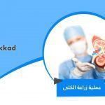 عملية زراعة الكلى