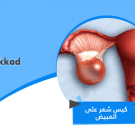 كيس شعر على المبيض