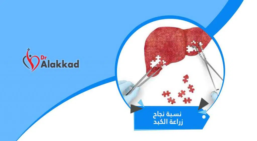 نسبة نجاح زراعة الكبد والعوامل التي تؤثر فيها