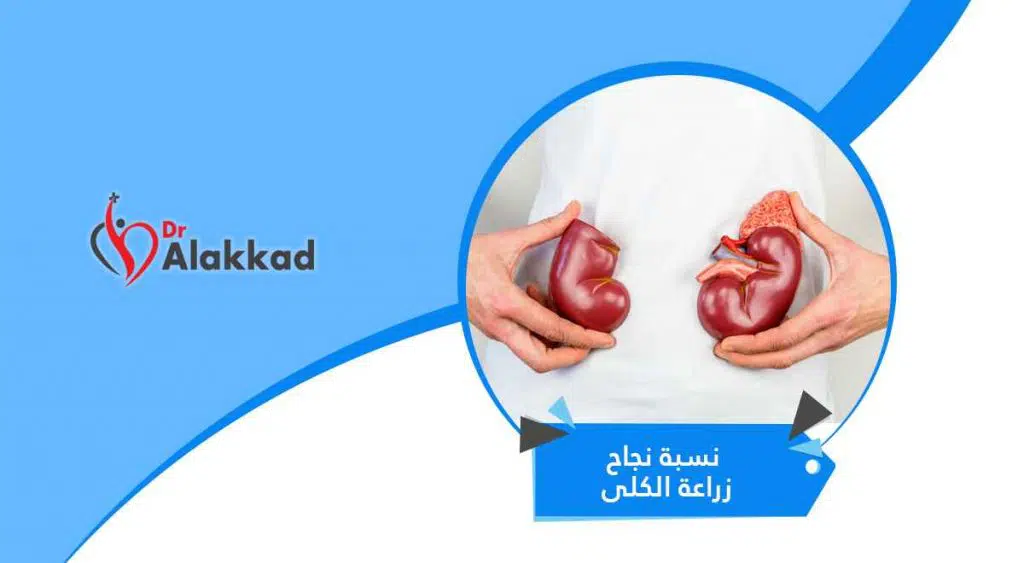 نسبة نجاح زراعة الكلى … كم يعيش زارع الكلى
