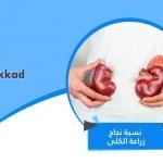 نسبة نجاح زراعة الكلى