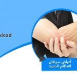 اعراض سرطان العظام الحميد
