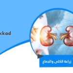 زراعة الكلى والجماع