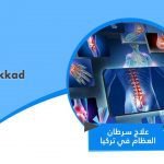 علاج سرطان العظام