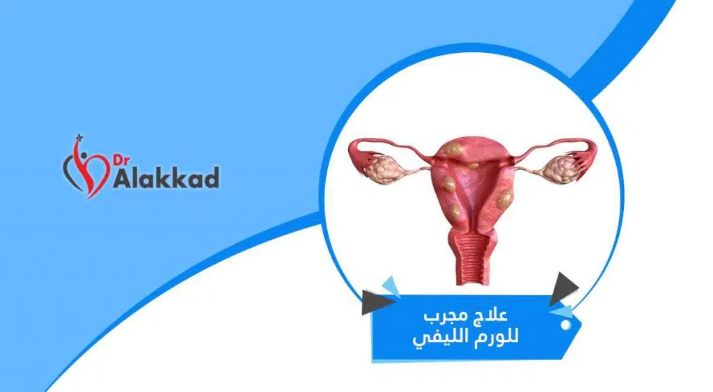 علاج مجرب للورم الليفي | الأدوية والجراحة والعلاجات البديلة