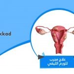 علاج مجرب للورم الليفي
