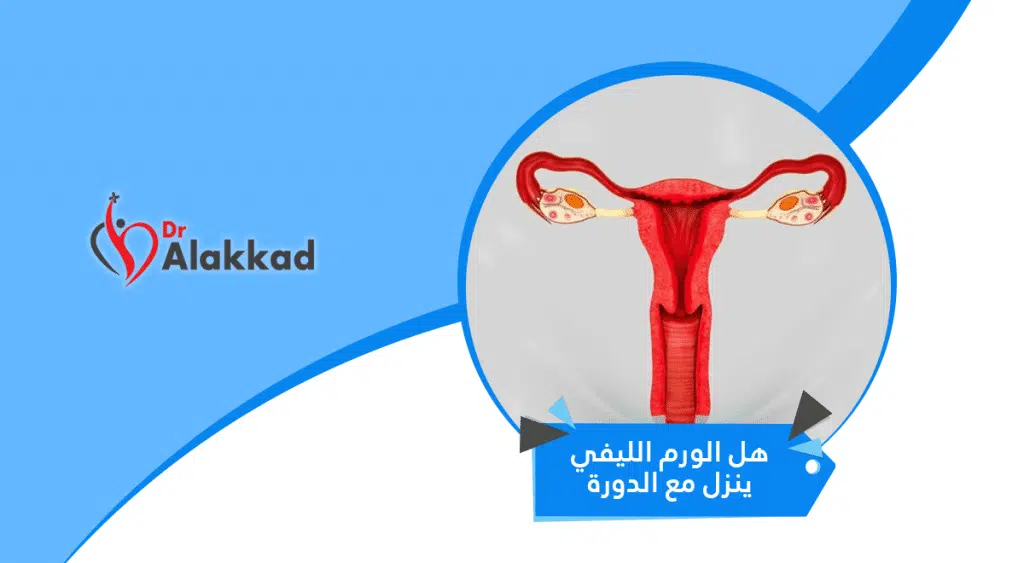 هل الورم الليفي ينزل مع الدوره؟ أعراض الورم الليفي وعلاجه