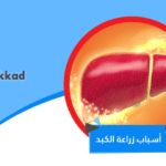 اسباب زراعة الكبد