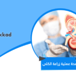 مدة عملية زراعة الكلى