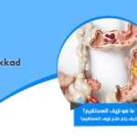ما هو نزيف المستقيم؟ كيف يتم علاج نزيف المستقيم؟