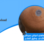ماهي اعراض سرطان الثدي وطرق العلاج