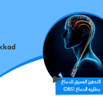 التحفيز العميق للدماغ (DBS) بطاريه الدماغ