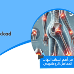 9 من أهم اسباب التهاب المفاصل الروماتويدي
