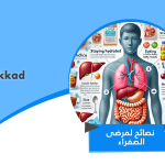 أهم 10 نصائح لمرضى الصفراء