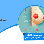 أهم مواصفات الكتلة السرطانية في الثدي