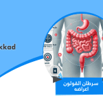 سرطان القولون اعراضه