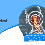 اعراض الانزلاق الغضروفي البسيط في الرقبة وكيفية تشخيصه وعلاجه